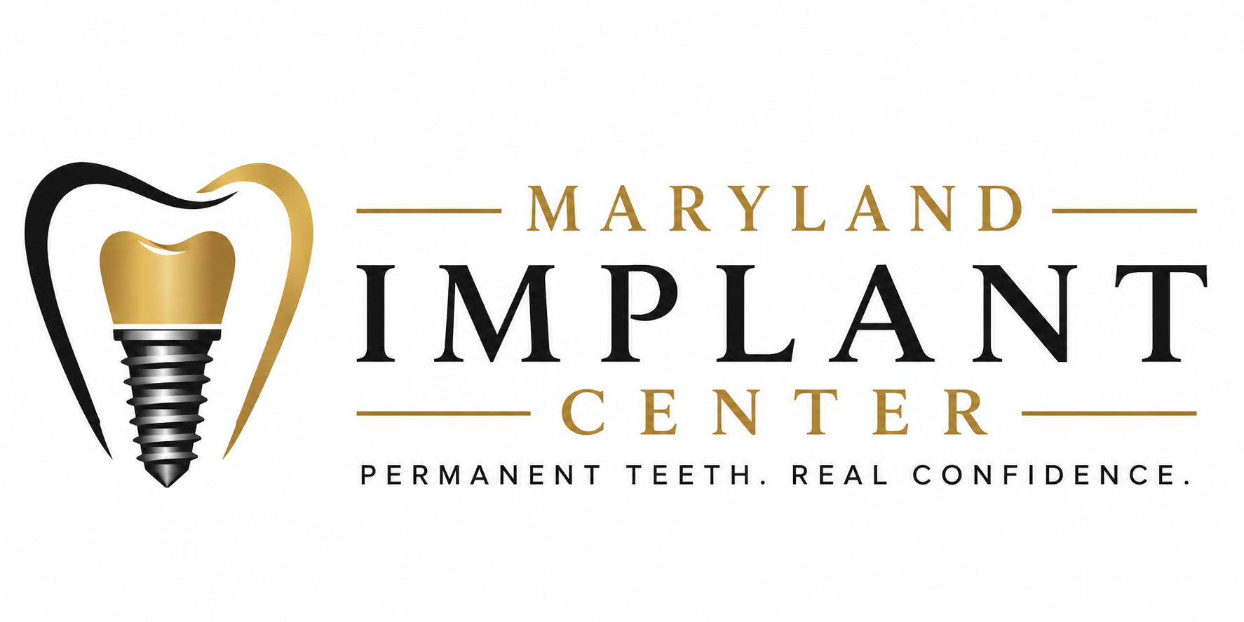 Maryland Implant Center | Dental Implants in Baltimore