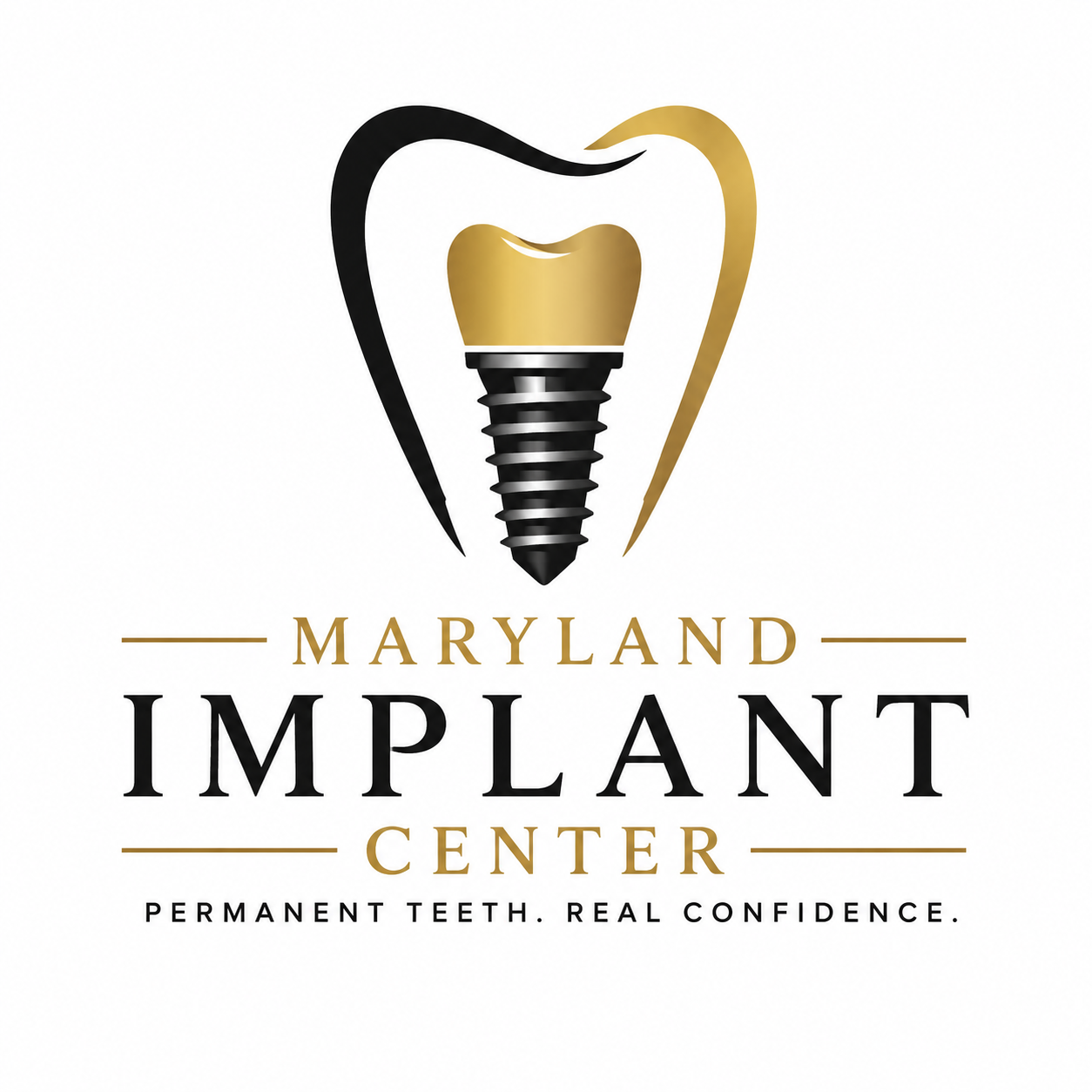 Maryland Implant Center | Dental Implants in Baltimore