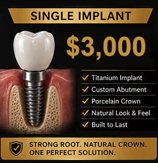 Single Implant